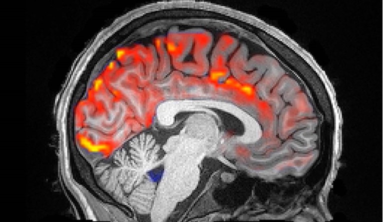 VIDEO Pogledajte kako moždana tekućina ispire naš mozak tijekom noći